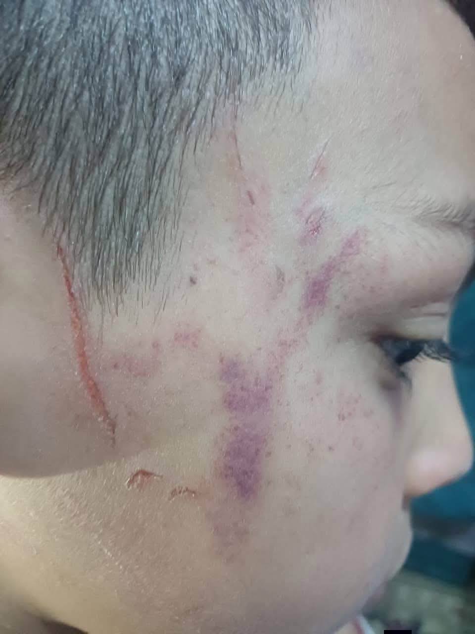 No photo description available.