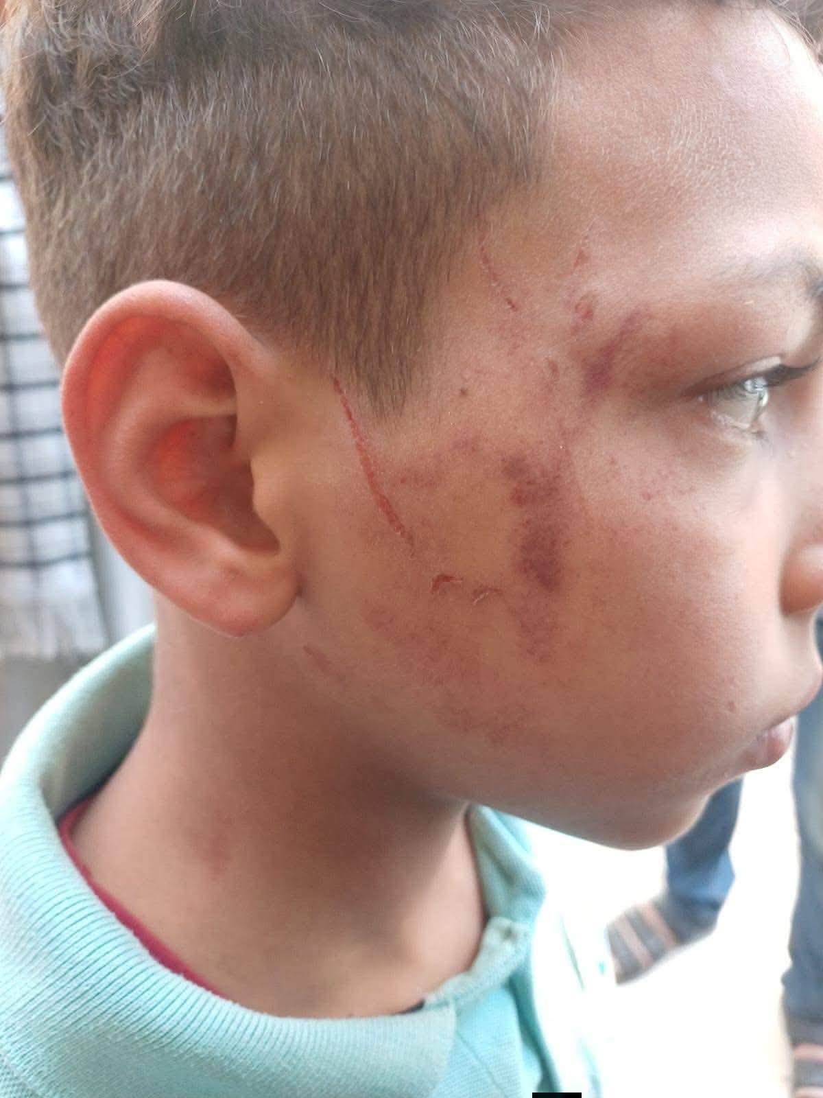 No photo description available.