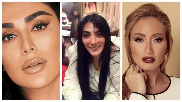 إجراءات تجميلية تسببت في تشوهات لعدد من الفنانات.. بالصور