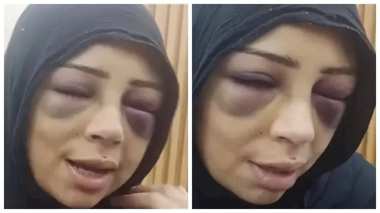 "مش أول مرة يضربني".. فتاة بورسعيد تحكي معاناتها مع خطيبها السابق (صور