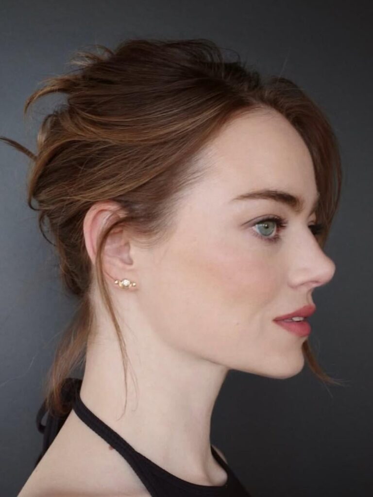 Emma Stone