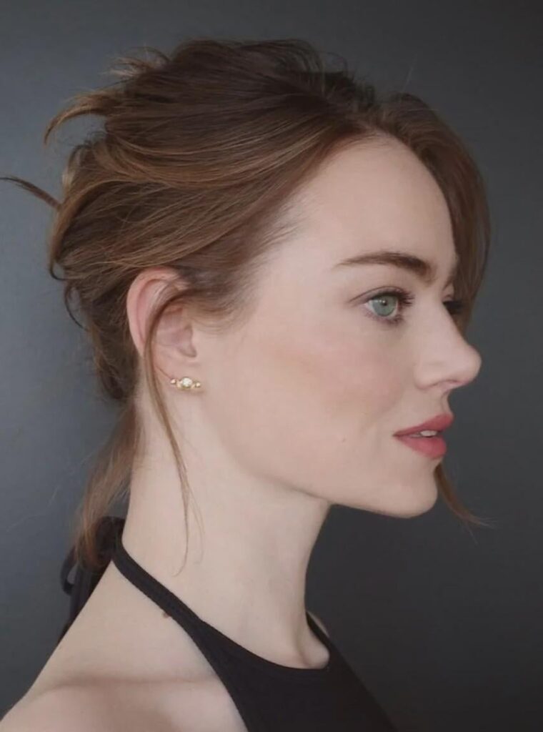 Emma Stone
