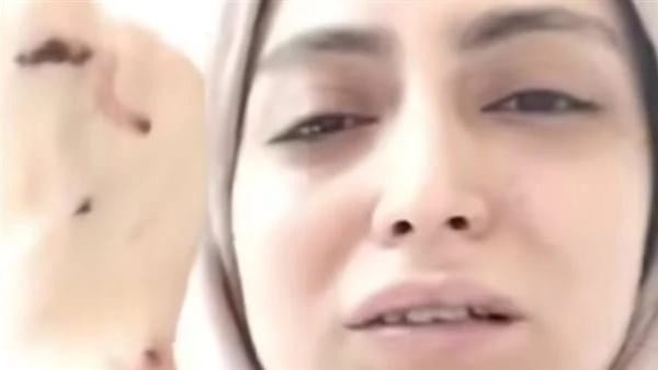ضبط 5 أشخاص في واقعة التعد.ي على طبيبة أسنان بشبرا الخيمة