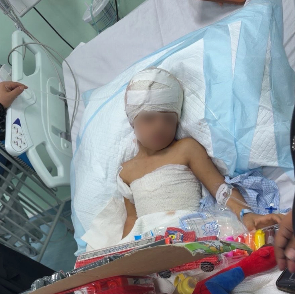 العناية الإلهية تنقذ طفلاً من الموت بين أنياب كلاب ضالة بطريف