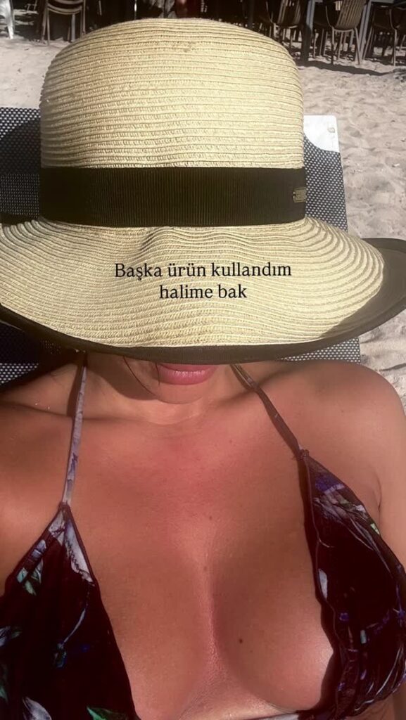 Berna Keklikler
