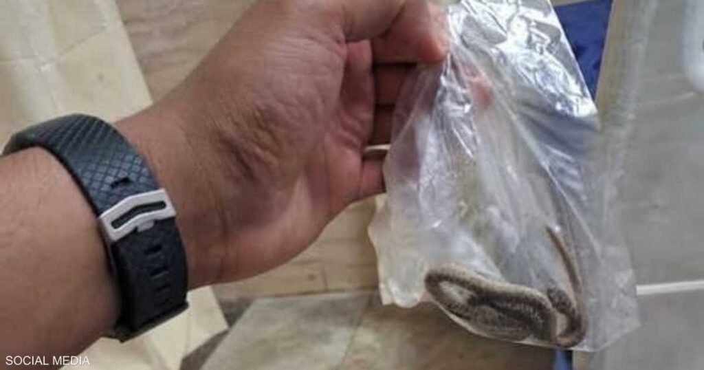تصرف "غريب" من مصاب.. يفتح ملف لدغات الأفاعي في مصر