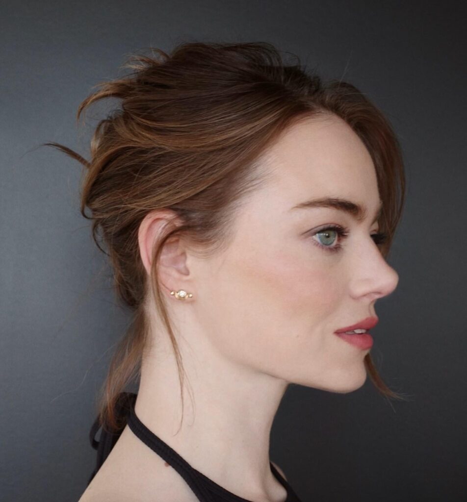Emma stone