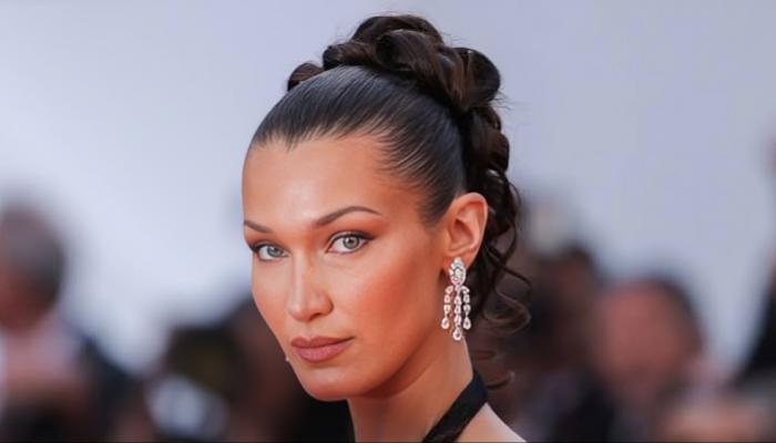 بيلا حديد تعيد الحديث عن تحديات المشاهير مع الأمراض المزمنة عارضة الأزياء العالمية بيلا حديد