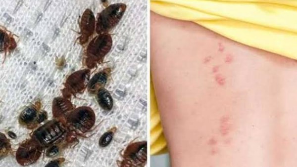 غزو بق الفراش للمنازل .. علامات وجوده وأفضل طرق التخلص منه فورًا غزو بق الفراش للمنازل .. علامات وجوده وأفضل طرق التخلص منه فورًا