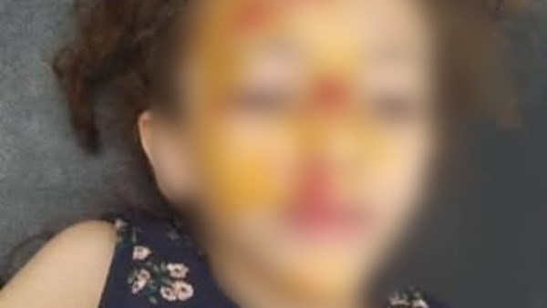 فيديو يوثق لحظة دهس “مليكة” بموتوسيكل يسير عكس الاتجاه في سوهاج فيديو يوثق لحظة دهس "مليكة" بموتوسيكل يسير عكس الاتجاه في سوهاج