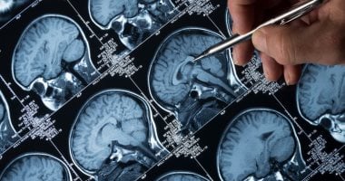 دراسة تحذر: 10 حالات صحية ترتبط بمرض الزهايمر قبل سنوات من التشخيص دراسة تحذر: 10 حالات صحية ترتبط بمرض الزهايمر قبل سنوات من التشخيص